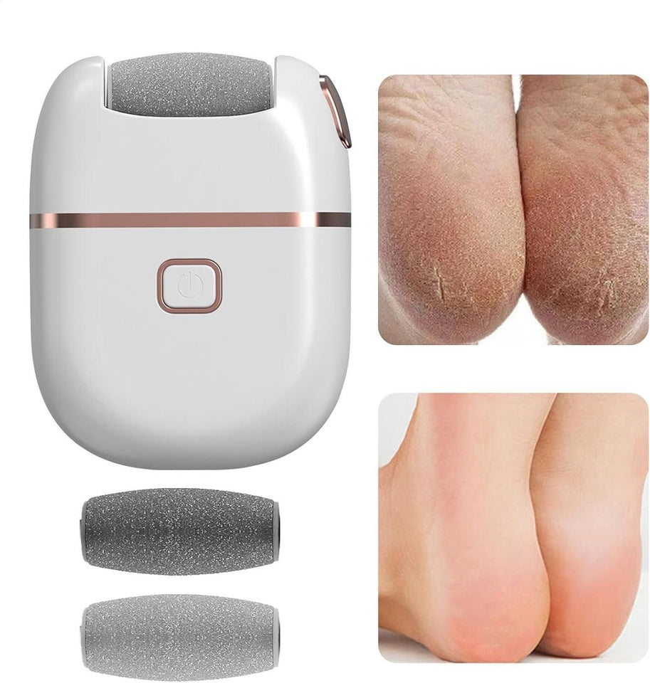 Ralphz Electronic Pedicure Tool