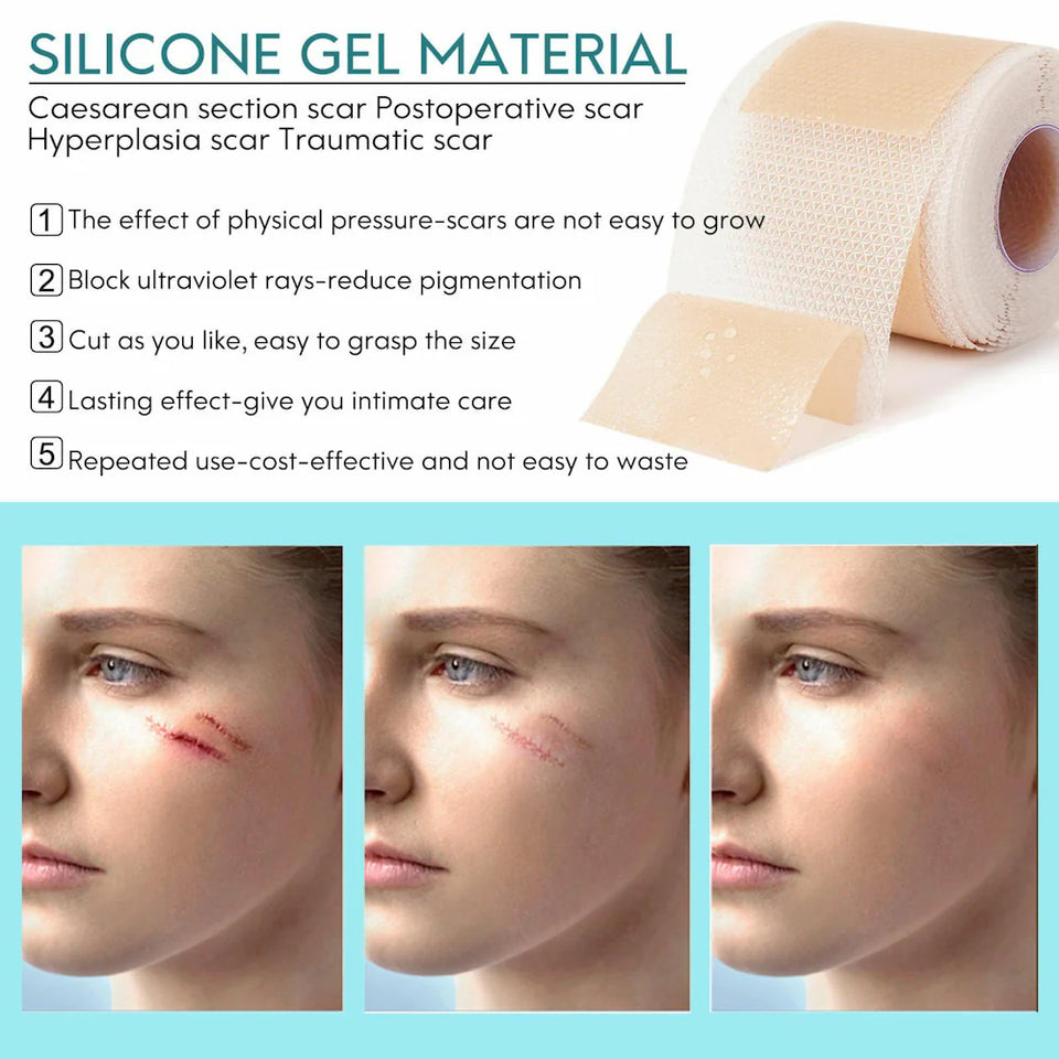Medical-Grade Scar sheets