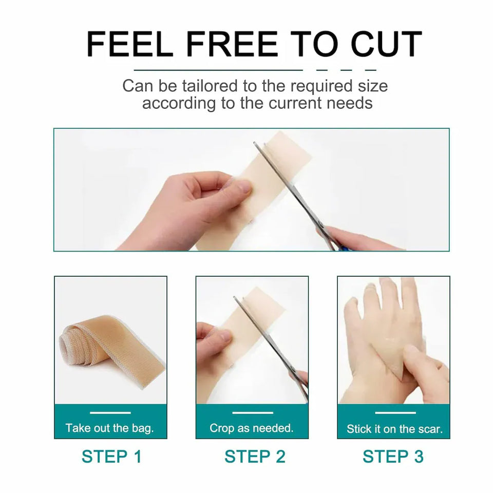 Medical-Grade Scar sheets