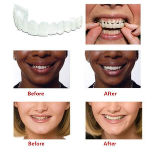 Golddentals Teeth Denture (Pack of 3)