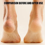 Ralphz Electronic Pedicure Tool